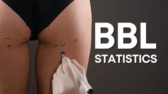 BBL Statistics – Risks, Death Rates, Trends, and other Brazilian Butt Lift Facts